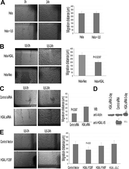 Figure 7. HGAL modulates IL-6 effects on cell migration: wound assay in HeLa-HGAL cells. Wound assays were performed as described in “Chemotaxis and wound assays.” (A) IL-6 effect on HeLa cell migration in wound assay. (B) IL-6 effect on migration of HeLa-HGAL and HeLA-Neo cells. HGAL expression significantly decreased migration of the cells. (C) siRNA knock-down of HGAL in the HeLa-HGAL cells markedly reversed the HGAL-mediated, IL-6–induced inhibition of cell migration. (D) Western blot analysis of HGAL protein expression in HeLa-HGAL cells following siRNA knockdown. (E) IL-6 effect on migration of HeLa-HGAL mutants. Left panel exhibits results of a representative wound assay in HeLa-HGAL Y128F and control cells. Right panel summarizes the effect of IL-6 on migration of HeLa-HGAL-Y128F, HGAL-128F, and HGAL-ΔC mutants. P value represents difference between HeLa-HGAL Y128F and control cells. Means and standard deviations of 3 independent experiments are demonstrated. See “Immunofluorescence microscopy” for image acquisition information.
