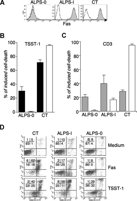 Figure 3. AICD of lymphocytes with a Fas deficiency. AICD was compared with Fas sensitivity in one Fas-deficient ALPS-0 patient and one highly Fas-defective ALPS-I patient (P3). (A) CD95 expression (gray histograms) on day 9 TSST-1-activated T cells from one ALPS-0 patient (P7), one ALPS-I patient (P3), and control (one representative evaluation of 3). (B) TSST-1-activated T cells were restimulated with TSST-1 () or (C) CD3-activated T cells were restimulated with anti-CD3 (), and Fas-induced apoptosis was measured in T cells from each culture using agonistic anti-CD95 (). Means and SEM of are from 5 (B) and 3 (C) independent experiments. As for WT lymphocytes, the proportion of CD4+ T cells is not significantly different in anti-CD3-activated (53.2% ± 11.8%) versus TSST-1-activated (57.7% ± 13.8%) blasts (data not shown). (D) Apoptotic cell death was detected after 6 hours of stimulation of day 9 TSST-1-activated T cells from ALPS-0, ALPS-I, and healthy control donor (CT) after reactivation by soluble TSST-1 or CD95 cross-linking, using Annexin-V detection (x axis) and 7AAD exclusion dye (y axis). One representative experiment of 3. Numbers on plots are percentages of total cells.