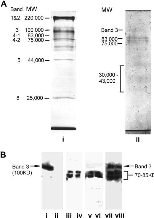 Figure 3. The spontaneous anti-RBC antibody response in AE−/− NZB mice targets antigens other than Band 3. (A) SDS-PAGE analysis of wild-type murine RBC membrane preparations stained for protein with Coomassie Blue (lane i), or for glycoprotein with PAS (lane ii). Each track was loaded with approximately 20 μg protein. Major protein and glycophorin bands of the RBC membranes are labeled32 and the apparent molecular masses are indicated in kDa. (B) Immunoprecipitation of biotin-labeled antigens from healthy murine RBCs. Immunoprecipitates were analyzed by SDS-PAGE, blotted onto nitrocellulose, and developed by luminography. Biotin-labeled RBCs were incubated with samples as follows: (i) positive control autoantibody-containing RBC eluate from wild-type NZB mice; (ii) negative control RBC eluate from healthy mice; (iii,iv) sera from individual AE−/− NZB mice; (v,vi) RBC eluates from individual AE−/− NZB mice; (vii,viii) control sera from individual AE−/− NZB mice immunized with Band 3. The apparent molecular mass of the specific bands precipitated is indicated in kDa. Lanes i, ii, iii, vi, vii, and viii are from different blots.
