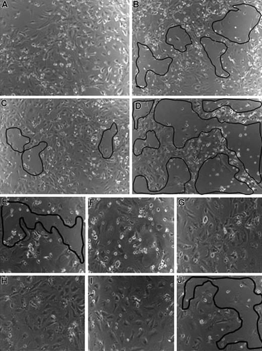 Figure 3. VEGF-C and -D are involved in CEACAM1-mediated endothelial survival. (A) CEACAM1-overexpressing HDMECs remain confluent under hunger conditions. In contrast, the treatment of CEACAM1-overexpressing HDMECs with antibodies against VEGF-C (B) and -D (C) leads to a detachment of endothelial cells from the well (marked areas). The detachment of endothelial cells is most prominent when empty vector-transfected HDMECs were treated with anti–VEGF-C (D). CEACAM1 silencing in HDMECs induces detachment of endothelial cells without any treatment (E), while luciferase-silenced HDMECs remain almost confluent (F). The treatment of CEACAM1- (G) and luciferase-silenced (H) HDMECs with VEGF-A improves their survival. The treatment with VEGF-C improves the survival of luciferase-silenced HDMECs (I) but not that of CEACAM1-silenced HDMECs, as visible by the area of cell detachment (J).