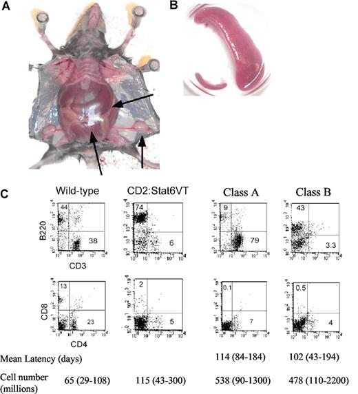 Figure 1. Lymphoproliferative disease in Stat6VT transgenic mice (A) Photograph of mouse with lymphoproliferative disease. Spleen is extended through entire peritoneum (). Lymphadenopathy is also apparent. (B) Comparison of spleen size from wild-type mouse (bottom left) compared with spleen from mouse with LPD. (C) Flow cytometric analysis of splenocytes from wild type, Stat6VT transgenic and 2 Stat6VT transgenic mice with LPD. Numbers in quadrants represent percentage of total spleen cells. Average latency (the age of the mouse, in days, at which the LPD was characterized) and averages of spleen cell numbers (range shown in brackets) are shown below (n = 11 for class A and n = 10 for class B).