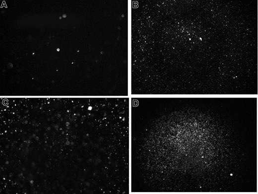 Figure 3. Light microscopy of PF4/heparin particles. Panels showing solutions containing mPF4 (200 μg/mL) alone (A) or mixed with UFH at 0.5 U/mL (B), 5 U/mL (C), or 50 U/mL (D) and subjected to light microscopy using highly collimated oblique illumination. Microscopic images were obtained using a 10 × magnification with an Olympus microscope (model no. BX41; Olympus America). Images were captured using a Microfibre Optronics camera (Goleta, CA) and analyzed with Picture frame Optronics software.