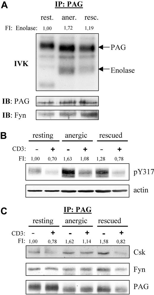 Figure 2. PAG is hyperphosphorylated in anergic T cells. (A) Anergic cells showed increased PAG-associated Fyn-kinase activity. PAG was immunoprecipitated from resting (rest.), anergic (aner.), and rescued (resc.) cells, and the PAG-associated kinase activity was measured by IVK. Phosphorylation was visualized by autoradiography (top panel). The amount of precipitated PAG and coprecipitated Fyn were detected by Western blotting (middle and bottom panels). Bands corresponding to PAG and enolase phosphorylation are marked. Phosphorylation of enolase was normalized with respect to the PAG level and is presented here as fold induction. (B) PAG was hyperphosphorylated in anergic cells. Resting, anergic, and rescued T cells were either left untreated (−) or stimulated via CD3 (MEM-92) for 2 minutes (+). Samples were then lysed, subjected to Western blotting, and probed with a phosphospecific antibody recognizing pY317 of PAG (top panel). Actin staining is shown for equal loading (bottom panel). The level of Y317 phosphorylation normalized to actin is presented as the fold-induction. (C) Hyperphosphorylated PAG recruits more Csk in anergic cells. Resting, anergic, and rescued cells were prepared as in panel B. PAG was immunoprecipitated and the associated proteins detected by blotting with anti-Csk and anti-Fyn antibody. The amount of Csk coprecipitated with PAG was normalized to the PAG level and is presented as fold induction.