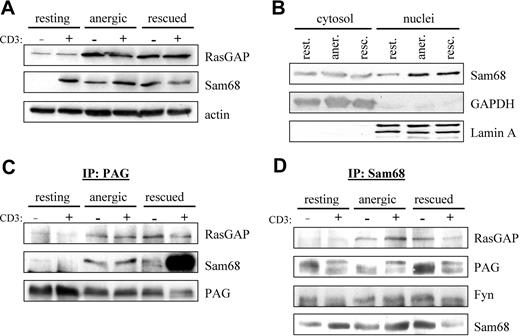 Figure 4. PAG formed a novel multiprotein complex with Fyn, Sam68, and RasGAP. (A) Increased Sam68 and RasGAP expression. Resting, anergic and rescued cells were untreated (−) or stimulated with MEM-92 for 2 minutes (+) before the lysis. Postnuclear lysates were blotted with specific antibodies against Sam68 and RasGAP. Actin staining is shown for equal loading. (B) To better determine whether Sam68 expression or localization was altered, cytoplasmic and nuclear fractions were prepared. GAPDH and Lamin A are presented as markers. (C) Sam68 and RasGAP associate with PAG. Cells were prepared as in panel A. PAG was then immunoprecipitated and associated proteins were detected by blotting with anti-RasGAP and anti-Sam68 antibody. The amount of precipitated material is shown with anti-PAG staining. (D) PAG, Fyn, and RasGAP association with Sam68. Samples prepared as in panel A were used to immunoprecipitate Sam68 and then probed with anti-RasGAP, anti-PAG, and anti-Fyn antibodies. The amount of precipitated material is shown by probing with anti-Sam68 antibody.