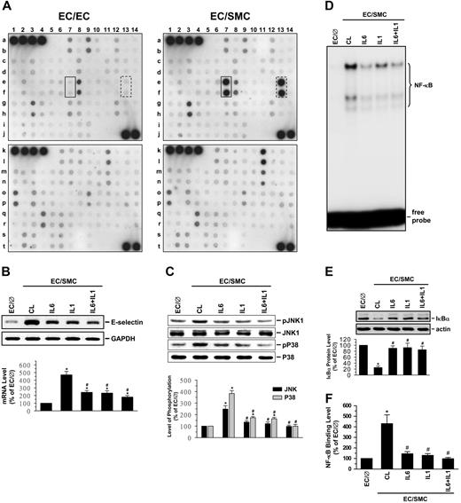 Figure 5. IL-1β and IL-6 produced by EC/SMC are the major factors contributing to the SMC-induced signaling and E-selectin expression in ECs. (A) Detection of protein levels of cytokines in conditioned media of EC/EC or EC/SMC coculture. The membranes spotted with antibodies against 120 different cytokines and other proteins (Figure S2) were incubated with 2-fold–diluted conditioned media of EC/EC or EC/SMC coculture and then incubated with a mixture of biotin-labeled antibodies, as described in “Materials and methods.” Signal detection by enhanced chemiluminescence (ECL) shows that the expression levels of IL-1β (spots in solid boxes) and IL-6 (spots in dash boxes) produced by EC/SMC were significantly higher than that of EC/EC. Results are representative of 4 independent experiments with similar results. (B-F) ECs were kept as controls (EC/∅) or cocultured with SMCs in the adjacent-bilayer model (EC/SMC) for 30 minutes (C-F) or 4 hours (B). In parallel experiments, ECs were preincubated with a neutralizing antibody against IL-1β or IL-6 (5 μg/mL for each) or their combination for 1 hour and then cocultured with SMCs in the presence of the antibodies. Control ECs were cocultured with SMCs in the presence of control IgG (CL). The E-selectin mRNA expression (B), JNK and p38 phosphorylations (C), NF-κB-DNA binding activity (D), IκBα protein expression (E), and in vivo NF-κB–promoter binding (F) were determined by using Northern blot analysis, Western blot analysis, EMSA, and ChIP assay, respectively, as described in “Materials and methods.” (B-C,E) Data are presented as percentage changes in band densities from control EC/∅ normalized to GAPDH RNA (B), JNK or p38 protein (C), or actin protein (E). The results shown are mean ± SEM from 3 to 4 independent experiments. *P < .05 versus control EC/∅. #P < .05 versus control EC/SMC.
