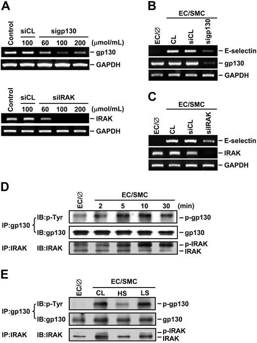 Figure 6. IRAK and gp130 contribute to the modulation of EC signaling and E-selectin expression by SMC-coculture and shear stress. (A) ECs were kept as controls or transfected with control siRNA (siCL) or a specific siRNA of gp130 (sigp130) or IRAK (siIRAK) at indicated concentrations for 48 hours, and their gp130 or IRAK mRNA expression was determined by RT-PCR analysis, as described in “Materials and methods.” (B-E) ECs were kept as controls (EC/∅) or cocultured with SMCs in the adjacent-bilayer model (EC/SMC) for 10 minutes (E), 4 hours (B-C), or indicated times (D). Before coculture with SMCs, ECs were transfected with control siRNA or a specific siRNA of gp130 (B) or IRAK (C) (100 μmol/mL for each) for 48 hours or were presheared at HSS (HS) or LSS (LS) for 24 hours (E). Control ECs (CL) were cocultured with SMCs without transfection (B-C) or preshearing (E). The mRNA expressions of E-selectin and gp130 (B) or IRAK (C), or the phosphorylations of gp130 and IRAK (D-E) in these ECs were determined by using RT-PCR analysis or immunoprecipitation assay and Western blot analysis, respectively. Results in (A-E) are representative of triplicate experiments with similar results.