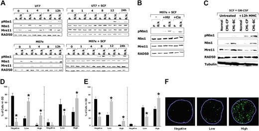 Figure 2. Enhanced phosphorylation of Nbs1 on serine 343 in BCR/ABL-positive cells on DNA damage. (A) M07e and UT7 parental (P) and their BCR/ABL (B/A) counterparts were treated with 0.5 μg/mL MMC in the presence or absence of SCF. pNbs1, total Nbs1, Mre11, and RAD50 were examined by Western-blot analysis at the indicated time points during MMC treatment. (B) M07e (P) and their BCR/ABL (B/A) counterparts were treated with 0.3 μg/mL cisplatin (Cis) or with 10 mM hydroxyurea (HU) for 12 hours in the presence of SCF. pNbs1, Nbs1, Mre11, and RAD50 were examined by Western-blot analysis. (C) CD34+ cells were isolated from healthy donors (Normal) and CML-CP and CML-BC patients. Cells were treated or not with 0.5 μg/mL MMC for 12 hours in the presence of GM-CSF and SCF. pNbs1, Nbs1, Mre11, RAD50, and tubulin were detected by Western blot analysis. Results are representative for 3 donors in each group. (D) M07e (■) and B/A-M07e (▩) cells and (E) CD34+ cells from healthy donors (■) and CML-BC patients (▩) were untreated (left panels) or treated (right panels) with 0.5 μg/mL MMC for 12 hours in the presence of GM-CSF and SCF. pNbs1 foci were detected in the nuclei by immunofluorescence; results represent mean (± SD) of the number of cells classified as negative (< 4 foci), low-positive (4-20 foci), or high-positive (> 20 foci). *P < .05, ▩ versus ■ in particular groups. (F) Representative nuclei scored as negative, low-positive, and high-positive for pNbs1 foci; nuclear borders are outlined in blue.