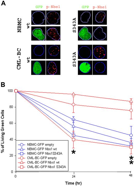 Figure 5. Nbs1-S343A mutant decreases MMC resistance in CML-BC cells. CD34+ NBMC and CML-BC cells were infected with pMig retroviral particles containing Nbs1-wt, Nbs1-S343A, or empty plasmid. (A) pNbs1 was examined by immunofluorescence after 0.1 μg/mL MMC treatment for 24 hours. Expression of GFP and detection of pNbs1 foci is shown in representative nuclei. (B) Survival of GFP+ cells 24 and 48 hours after MMC treatment was determined using trypan blue exclusion. Results represent mean (± SD) for 2 donors each for NBMC and CML-BC. *P < .04, CML-BC-GFP Nbs1-S343A in comparison to CML-BC-GFP empty and CML-BC-GFP Nbs1-wt, and NBMC-GFP-Nbs1-S343A in comparison to NBMC-GFP empty and NBMC-GFP Nbs1-wt; **P < .02, CML-BC-GFP Nbs1-S343A in comparison to CML-BC-GFP empty and CML-BC-GFP Nbs1-wt.