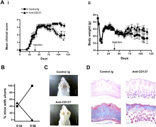 Figure 2. Anti-CD137 reverses cutaneous GVHD. Anti-CD137 (200 μg per mouse) was administered one time 34 days after induction of cGVHD and changes of clinical scores and body weight were evaluated thereafter. Data were combined from 3 experiments (n = 14 for control Ig group; n = 18 for anti-CD137 group). (Ai) Changes of mean clinical scores. *P < .05, between the 2 groups. (Aii) Changes of body weight. (B) Comparison of the percentage of mice with ulcers between day 34 and day 58 after disease induction. (C) Gross observation of the skin lesions in the posterior neck area at day 58. (D) Histopathology of the skin at day 58. (Upper column) H&E staining; (lower column) Masson trichrome staining. Images were acquired by a BX51 Olympus light microscope (Tokyo, Japan) 4×/0.10 oil objective, and an Olympus C-3000 zoom camera and processed using Image-Pro Plus, version 4 (MediaCybernetics, Silver Spring, MD). Original magnification, 40 ×.