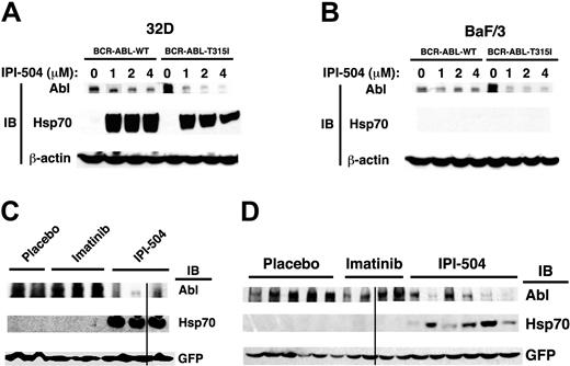 Figure 4. Hsp90 inhibition has differential effects on BCR-ABL degradation and Hsp70 induction in myeloid and lymphoid cells in vitro and in vivo. (A) In 32D cells, IPI-504–induced degradation of BCR-ABL-T315I was greater than that of BCR-ABL-WT. BCR-ABL-WT– or BCR-ABL-T315I–expressing 32D cells were treated with different concentrations of IPI-504 for 12 hours. Protein lysates were analyzed by Western blotting using antibodies indicated. (B) In Ba/F3 cells, IPI-504 induced significant degradation of BCR-ABL-T315I but not BCR-ABL-WT. BCR-ABL-WT– or BCR-ABL-T315I–expressing 32D cells were treated with different concentrations of IPI-504 for 12 hours. Protein lysates were analyzed by Western blotting using antibodies indicated. (C) Mice with BCR-ABL-T315I–induced CML were treated with placebo, imatinib (100 mg/kg, twice a day by gavage), and IPI-504 (50 mg/kg, once every 2 days by gavage), respectively, for 8 days, beginning at day 8 after transplantation. At 6 hours after the last dose, protein lysates of leukemic cells from the spleen of the treated CML mice were analyzed by Western blotting using antibodies indicated. The black line indicates that the lanes that were not adjacent on the same original Western blotting gel were brought together to generate this figure. (D) Mice with BCR-ABL-T315I–induced B-ALL were treated with placebo, imatinib, and IPI-504, respectively, for 8 days, beginning at day 8 after transplantation. At 6 hours after the last dose, protein lysates of leukemic cells from the spleen of the treated mice were analyzed by Western blotting using antibodies indicated. The black line indicates that the lanes that were not adjacent on the same original Western blotting gel were brought together to generate this figure.