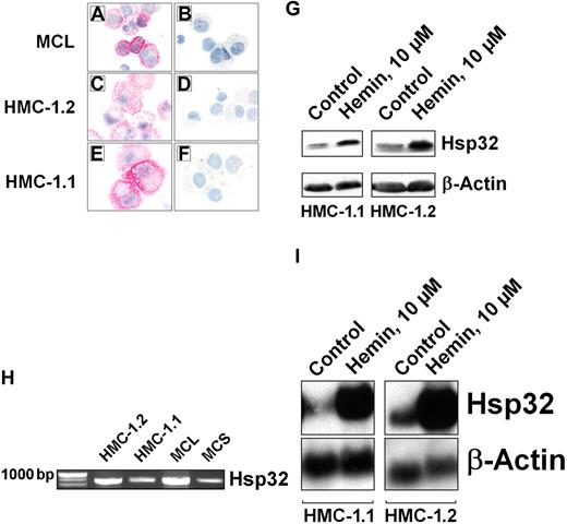 Figure 1. Expression of Hsp32 in neoplastic mast cells. Immunocytochemical detection of Hsp32 in primary neoplastic MCs in a patient with mast cell leukemia (A-B), in HMC-1.2 cells expressing KIT D816V (C-D), and in HMC-1.1 cells lacking KIT D816V (E-F), using an antibody against Hsp32. Before being applied, the antibody was preincubated with control-buffer (A,C,E) or a specific blocking-peptide (B,D,F). Acquisition of figures was performed by an Olympus DP11 camera connected to an Olympus BX50F4 microscope equipped with 100 ×/1.35 UPlan-Apo objective lenses (Olympus, Hamburg, Germany). Images were acquired with Adobe Photoshop CS2 software version 9.0 (Adobe Systems, San Jose, CA) and processed with PowerPoint software (Microsoft, Redmond, WA). (G) Western blot analysis of Hsp32 expression in HMC-1.1 cells and HMC-1.2 cells after exposure to control medium or hemin (10 μM; 37°C, 4 hours). Western blotting was performed using antibodies specific for Hsp32 or β-actin (loading control). (H) Detection of Hsp32 mRNA by RT-PCR in HMC-1 cells and highly enriched KIT-sorted neoplastic MCs obtained from 1 patient with mast cell leukemia (MCL) and 1 patient with mast cell sarcoma (MCS). RT-PCR was performed as described in “Materials and methods, Northern blot analysis and RT-PCR.” (I) Northern blot analysis of expression of Hsp32 mRNA in HMC-1.1 and HMC-1.2 cells after incubation in control medium or hemin (10 μM, 37°C) for 4 hours. Northern blotting was performed using DNA probes specific for Hsp32 or β-actin. As assessed by densitometry, hemin induced a 10-fold up-regulation of Hsp32 mRNA in HMC-1.1 cells, and a 20-fold up-regulation in HMC-1.2 cells.