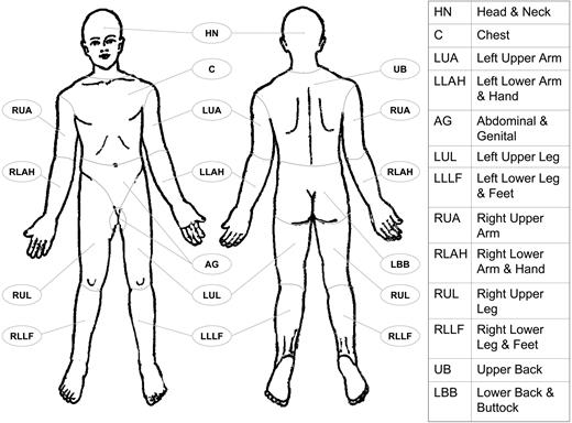 Figure 1. Body regions as defined in the proposed TNM system for the designation of T (skin involvement) category. Left and right extremities are assessed as separate body regions. The designation of these body regions are based on regional LN drainage patterns.