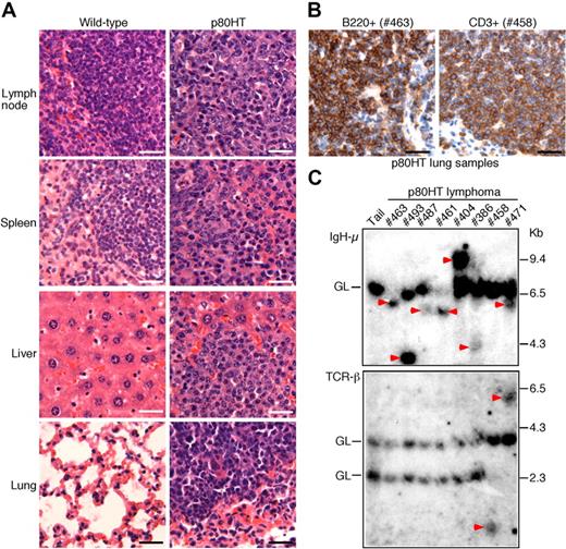 Figure 3. p80HT transgenic mice develop disseminated B or T cell lymphomas. (A) Histopathologic analysis of lymphomas in p80HT mice by hematoxylin and eosin staining. The normal architecture shown in the wild-type organs are completely effaced by extensive lymphocyte infiltrations in the organs from a dead p80HT mouse. (B) Immunohistochemical examination of p80HT mouse lung sections with malignant lymphocyte infiltration. The sections stained strongly either for B220 (a B cell marker) or CD3 (a T cell marker), indicative of B or T cell lymphomas. Scale bars in panels A and B, 50 μm. (C) Southern blot analysis of IgH (top) and TCR (bottom) gene rearrangements in representative lymphoma samples. EcoRI-digested DNA was hybridized with an IgH-μ JH4 probe or with a TCR Cβ1 probe. Tail DNA from a p80HT mouse was used as control for the germ line (GL) IgH and TCR loci. Arrowheads indicate rearrangements at either the IgH-μ or the TCR-β locus. Size markers in kilobases are shown to the right.