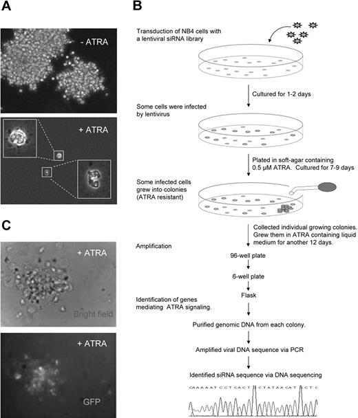Figure 1. Identification of suppressors of ATRA-mediated cell growth arrest using an shRNA screening approach. (A) Soft-agar colony-formation assay. NB4 cells grew into colonies in RPMI/0.2% in the absence of ATRA. In the presence of 0.5 μM ATRA, NB4 cells stopped proliferation in soft agar and differentiated into mature neutrophils in 7 days. Cells were plated at a density of 5 × 105 cells/100-mm plate. Images were captured using a 20× dry objective (NIA 0.5) on an Olympus IX-71 microscope (Melville, NY). Images were acquired using a CCD camera (SensiCam, Cooke, Romulus, MI) controlled by IPLab imaging software (IPLab, Rockville, MD). The figure shows the results of a representative experiment. (B) The experimental flow chart of the functional shRNA screening. Details are provided in “Retroviral infection for high-throughput shRNA screening.” (C) An ATRA-resistant positive colony identified from the initial screening. This colony is GFP positive and thus contains the inserted viral sequence. The images were acquired as described in panel A.