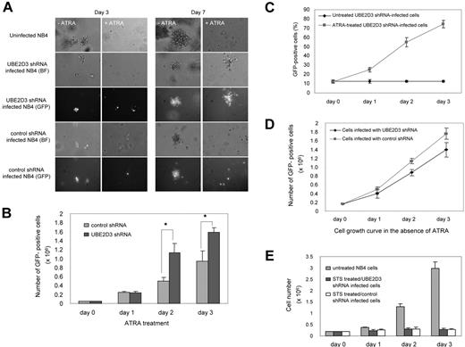 Figure 2. shRNA knockdown of UBE2D3 suppresses ATRA-induced cell growth arrest. (A) Colony-forming assay in soft agar. Uninfected, control shRNA-infected, and UBE2D3 shRNA-infected NB4 cells were seeded in soft-agar plates in the presence (0.5 μM) or absence of ATRA. The expression of shRNA by the infected cells was confirmed by their coexpression of GFP. The figure shows the results of a representative experiment. Pictures at day 3 and day 7 are presented. Images were viewed using an Olympus 20×/0.5 NA dry objective microscope (Olympus, Melville, NY) and SensiCam CD camera (Cooke, Romulus, MI) and processed using IPlab imaging software (IPlab, Rockville, MD). (B) shRNA knockdown of UBE2D3 suppresses ATRA-induced cell growth arrest in liquid cultures. Control shRNA and UBE2D3 shRNA-infected NB4 cells were cultured in liquid medium containing 0.5 μM ATRA. At each indicated time point, the total number of cells was counted by hemocytometer. The percentages of transduced cells (n %) were analyzed for GFP expression by flow cytometry. The total number of infected cells equals the total amount of cells times n %. Bars indicate 1 standard deviation (SD) about the mean (n = 6, * P < .01). (C) Confirmation of the ATRA resistance by a liquid culturing assay. NB4 cells were infected with UBE2D3 shRNA viruses. The infection efficiency is 10% to 15% under our experimental condition. The infected cells (including 10%-15% infected and 85%-90% uninfected cells) were continuously cultured in liquid medium with or without 0.5 μM ATRA. The percentages of transduced (GFP positive) cells were analyzed by flow cytometry every day. The increase of this number indicates a growth advantage of these cells over the uninfected cells. Data presented are the means (± SD) of 6 independent experiments. (D) shRNA knockdown of UBE2D3 does not promote NB4 cell growth in the absences of ATRA. Cell proliferation was analyzed as described in (B). Data presented are the means (± SD) of 6 independent experiments. (E) shRNA knockdown of UBE2D3 does not suppress staurosporine (STS)-induced cell growth arrest. Control shRNA and UBE2D3 shRNA-infected NB4 cells were cultured in the presence of 0.5 μM staurosporine and the cell growth was assessed as described in (B). Data presented are the means (± SD) of 3 independent experiments.