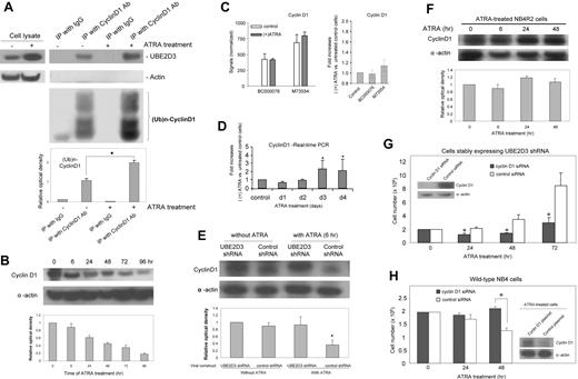 Figure 4. Cyclin D1 is a target of UBE2D3. (A) UBE2D3 physically associates with cyclin D1 in both ATRA-treated (48 hour) and untreated NB4 cells, and ATRA treatment leads to increased ubiquitination of cyclin D1. Cell lysates were immunoprecipitated with cyclin D1 antiserum or IgG. The precipitates were blotted with monoclonal anti-UBE2D3, antiubiquitin, as well as antiactin antibodies. The left two lanes contain small aliquots of the whole-cell lysates used for coimmunoprecipitation. The experiments were repeated multiple times. The figure shows the results of a representative experiment. The levels of ubiquitinated cyclin D1 were quantified using NIH ImageJ software. All samples were compared with the signal detected in untreated NB4 cell lysate immunoprecipitated with anti-cyclin D1 antiserum (lane 3). Data presented are the means (±SD) of 3 independent experiments. *P < .001. (B) Cyclin D1 protein level is down-regulated in ATRA-treated NB4 cells. NB4 cells were cultured in the presence of 0.5 μM ATRA for the indicated time. Cyclin D1 and actin were detected by Western-blotting analysis. The relative amounts of cyclin D1 protein were quantified using NIH ImageJ software. The cyclin D1 signals were normalized to the amount of actin in each sample. All samples were compared with the signal detected in untreated (time point 0) NB4 cells. Data are presented as mean values from 3 independent experiments whose results varied less than 5%. (C) Cyclin D1 mRNA level in ATRA-treated NB4 cells analyzed by RNA microarray. Cyclin D1 mRNA expression was analyzed using the same microarray data as described in Figure 3B. Both absolute values (left) and fold increases (right) were presented. The IDs of each oligomeric probe are indicated. Data presented are the means (± SD) of 3 independent experiments. (D) Cyclin D1 mRNA level in ATRA-treated NB4 cells analyzed by real-time quantitative PCR. The experiment was conducted as described in Figure 3C. Shown are fold increases over untreated cells. Data presented are the means (±SD) of 3 independent experiments. *P < .01. (E) UBE2D3 shRNA completely abolished ATRA-induced cyclin D1 degradation in NB4 cells. Control shRNA and UBE2D3 shRNA-infected NB4 cells were incubated with or without 0.5 μM ATRA for 6 hours. The GFP-positive shRNA-expressing cells were sorted on a MoFlo High-Performance cell sorter. Protein extracts were resolved on SDS-PAGE and the amounts of cyclin D1 protein were measured as described in panel B. Data presented are the means (± SD) of 3 independent experiments. *P < .001. (F) ATRA-induced cyclin D1 degradation could not be detected in the ATRA-resistant NB4-R2 cells. ATRA treatment and quantification of cyclin D1 protein level by Western blotting were conducted exactly as described in panel B. (G) Knocking down cyclin D1 protein by siRNA inhibits the growth of UBE2D3-shRNA-expressing NB4 cells in the presence of ATRA (abrogates the effect of the UBE2D3 shRNA). NB4 cells stably expressing UBE2D3 shRNA (2 million) were transfected with human cyclin D1 siRNA (100 pmol) (Santa Cruz Biotechnology, Santa Cruz, CA) or control siRNA (100 pmol) using a Nucleofector Kit (Amaxa, Koeln, Germany) and a protocol provided by the manufacturer. Using this electroporation-based method, transfection efficiencies (for siRNA) of greater than 80% are routinely obtained. Transfected NB4 cells were cultured in the presence of 0.5 μM ATRA and the cell growth was assessed as described in Figure 2B. Data presented are the means (± SD) of 3 independent experiments. *P < .01 versus cells transfected with control siRNA. (Inset) Western blot result showing the specific knockdown of cyclin D1 protein. (H) Overexpression of cyclin D1 suppresses ATRA-induced cell growth arrest in NB4 cells (mimics the effect of the UBE2D3 shRNA). NB4 cells (2 ×106) were transfected with a cyclin D1 expression plasmid (6 μg; Open Biosystems, Huntsville, AL) or a pEGFP expression plasmid (control) using the Nucleofector Kit. We routinely obtain transfection efficiencies (for plasmid) of greater than 20% using this method. Transfected NB4 cells were cultured in the presence of 0.5 μM ATRA and the cell growth was assessed as described in Figure 2B. The ATRA-resistant cells gain growth advantage in ATRA-containing medium. Data presented are the means (± SD) of 3 independent experiments. *P < .01 versus cells transfected with control plasmid. (Inset) Western blot result showing the overexpression of cyclin D1 protein in ATRA-treated (3 days) NB4 cells.