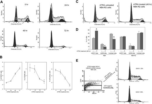 Figure 5. shRNA knockdown of UBE2D3 suppresses ATRA-induced cell-cycle arrest. (A) Cell-cycle analysis of ATRA-treated NB4 cells. NB4 cells were cultured in the presence of 0.5 μM ATRA for the indicated time. Cells were stained with propidium iodide and the cellular DNA content, which was reflected by PI staining, was analyzed by FACS using the Cell Quest software (Becton Dickinson). The percentage of cells in each cell-cycle phase was determined using a ModFIT software (Becton Dickinson), which deconvolves the flow-cytometer data. At least 10 000 cells were analyzed for each data point. (B) The cell percentages obtained from panel A were plotted against times of ATRA treatment. Data presented are the means (± SD) of 3 independent experiments. (C) ATRA treatment does not alter cell-cycle distribution in ATRA-resistant NB4-R2 cells. ATRA treatment and cell-cycle analysis were conducted exactly as described in panel A. (D) The proportions of cells that are in each cell-cycle phase were compared between ATRA-treated NB4 cells and NB4-R2 cells. Data presented are the means (± SD) of 3 independent experiments P < .01 versus untreated cells. (E) shRNA knockdown of UBE2D3 suppresses ATRA-induced G0/G1 arrest in NB4 cells. UBE2D3 shRNA-infected NB4 cells were incubated in the presence of 0.5 μM ATRA for 48 hours. Viral-infected and uninfected cells were gated by their high and low fluorescent intensity, respectively. Cell-cycle analysis was carried out as described in panel A. Data are presented as mean values from 3 independent experiments whose results varied less than 5%.
