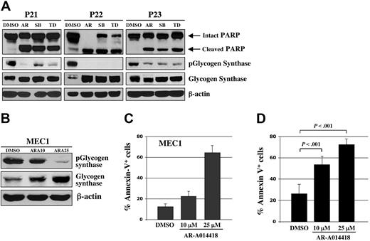 Figure 2. Pharmacologic inhibition of GSK-3 induces apoptosis in CLL cells. (A) Malignant B cells from 3 patients with CLL were treated with 25 μmol/L concentrations of the 3 distinct GSK-3 inhibitors AR-A014418 (AR), SB216763 (SB), TDZD8 (TD), or diluent (DMSO); 24 hours after treatment, the cell pellet was collected and protein was obtained. Cell lysates were separated by SDS-PAGE, transferred to PVDF membrane, and immunoblotted with the indicated antibodies. (B) MEC1 CLL cells were treated with DMSO or AR-A014418 at indicated concentrations for 24 hours and protein expression was analyzed as described in (A). ARA10 = 10 μmol/L AR-A014418; ARA25 = 25 μmol/L AR-A014418. (C) MEC1 cells were treated for 24 hours with DMSO or AR-A014418 at indicated concentrations, then assayed for apoptosis using Annexin-V-FITC staining as determined by flow cytometry. Columns, mean; bars, standard deviation (SD). (D) Malignant B cells from 10 patients with CLL were treated for 48 hours with diluent (DMSO) or AR-A014418 at indicated concentrations, then assayed for apoptosis using Annexin-V-FITC staining as determined by flow cytometry (mean ± SD; n = 10). Columns, mean; bars, SD.