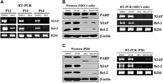 Figure 4. Inhibition of GSK-3 decreased NFκB-mediated expression of antiapoptotic molecules in CLL cells. (A) CLL B cells from patients with CLL were treated with diluent (DMSO) or 25 μmol/L AR-A014418; 12 hours after treatment, the cell pellet was collected and RNA was obtained. RT-PCR analysis was performed as described in “Materials and methods.” P = patient; B2M = β-2-microglobulin. (B) MEC1 cells were treated with diluent (DMSO), 25 μmol/L AR-A014418 (ARA), 50 μmol/L Z-VAD-FMK (ZVAD), or AR-A014418 + Z-VAD-FMK; the cell pellet was collected and RNA (12 hours after treatment) and protein (24 hours after treatment) were obtained. Cell lysates were separated by SDS-PAGE, transferred to PVDF membrane, and immunoblotted with the indicated antibodies (left panel). RT-PCR analysis was performed as described in “Materials and methods.” (C) CLL B cells from a patient with CLL were treated with diluent (DMSO) or 25 μmol/L AR-A014418 (ARA), 50 μmol/L Z-VAD-FMK (ZVAD), or AR-A014418 + Z-VAD-FMK; the cell pellet was collected and RNA (12 hours after treatment) and protein (24 hours after treatment) were obtained. mRNA and protein expression analysis was performed as described in panel B.