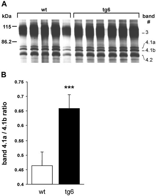Figure 5. Band 4.1a to 4.1b ratio. (A) Silver-stained SDS–polyacrylamide gel electrophoresis (PAGE) of erythrocyte membrane proteins. Samples were isolated form 5 wt and 6 tg6 individuals and the part of the gel containing bands 3 through 4.2 labeled according to Steck21 is shown. (B) Quantification of the band 4.1a to 4.1b ratio by densitometry revealed an increased ratio in tg6 red cell membranes, which is typical for senescent erythrocytes. Means (± SD); n = 5-6; ***P < .001.