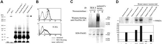 Figure 5. Bovine apoB-100 is the predominant target of the antibody response in patients treated with FCS cultured cells. (A) FCS was immunoprecipitated by isotype-matched control IgG1, 3E8.1 mAb, serum samples from 2 healthy human volunteers, or 2 serum samples from ADA-SCID patients in a gene therapy trial. Samples were analyzed by SDS-PAGE. (B) BW cells were incubated with the FITC-conjugated IgG fraction of serum from patient 2 with (dotted light line) or without (thick solid line) 3E8.1 mAb. (C) FCS treated with ( + ) or without (−) neuraminidase was immunoprecipitated by 3E8.1 or by serum from patient 2 and analyzed by SDS-PAGE (lower panel) or by Western blotting with anti-Neu5Gc antibody (upper panel). (D) FCS immunoprecipitated by serum from a healthy human volunteer, by serum from patient 2, or by serum samples from 4 patients in the breast cancer vaccine trial, were analyzed by SDS-PAGE. The definitions of + and − are in “Materials and methods, Patient sera/plasma from clinical trials and healthy donor cells.”
