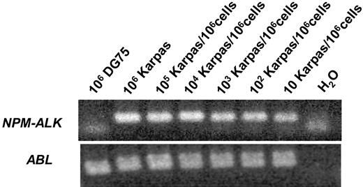 Figure 1. Sensitivity of the qualitative RT-PCR for NPM-ALK. NPM-ALK–positive Karpas 299 cells were diluted in DG 75 Burkitt lymphoma cells.