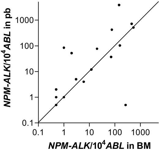 Figure 2. Comparison of quantitative NPM-ALK PCR results between bone marrow and peripheral blood. Number of NPM-ALK copies/104 copies ABL in bone marrow and peripheral blood of 19 patients with a positive RT-PCR in bone marrow and blood.