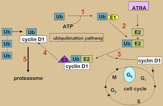ATRA up-regulates UBE2D3 (E2) in APL cells, leading to ubiquitination of cyclin D1 (steps 1–4, numbered in red; see text). Monoubiquitinated cyclin D1 is then polyubiquitinated and degraded in the proteasome (step 5). In the absence of UBE2D3, cyclin D1 is not degraded and cells continue to cycle.