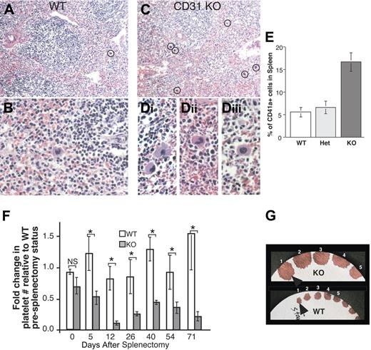 Figure 5. Increased extramedullary splenic megakaryocytopoieis in PECAM-1 null spleens. (A,C) Low-power (5×) hematoxylin and eosin analyses of WT and CD31KO spleen sections. Circled are megakaryocytes identified by their morphologies. (B) Higher-power (20×) magnification of panel A. (D) Higher power (20×) magnifications of panel C. (E) The percentage of splenic megakaryocytic CD41a+ cells identified by FACS analyses was found to be increased in CD31KO spleens compared with that found in Het and WT littermate spleens (n = 2). (F) Splenectomies on WT and CD31KO mice were performed, and peripheral platelet counts were determined over a 70-day period (WT, n = 4; CD31KO, n = 3). (G) Representative bleeding time assay of age-matched splenectomized CD31KO (top panel) and WT mice (bottom panel) illustrating the increased volume of blood lost over time in the CD31KO animals. Numbers 1 through 5 denote consecutive 30-second intervals following tail clip starting at time 0 (arrowheads). Vertical lines in the bar graphs represent standard deviations.