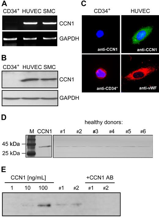 Figure 4. CCN1 expression in CD34+ cells and in human plasma. (A) RNA from CD34+ cells, HUVECs and SMCs were isolated, reverse transcribed and amplified by PCR using specific primers for CCN1 and GAPDH. (B) Cell lysates from CD34+ cells, HUVECs and SMCs were subjected to Western blot analysis using antibodies against CCN1 and GAPDH. (C) Immunofluorescent staining of CD34+ cells and HUVEC with antibodies against CCN1, CD34+ and CCN1, von Willebrand factor (VWF), respectively. Nuclei were counterstained with Hoechst (original magnification ×1000). (D) Plasma samples from healthy donors (#1-#6) were subjected to Western blot analysis using antibodies against CCN1. Recombinant CCN1 was used as positive control (M, protein marker). (E) CCN1 standards containing 1, 10, or 100 ng/mL of recombinant CCN1 protein and plasma from healthy donors (1 and 2), untreated and preabsorbed with a neutralizing antibody against CCN1 were subjected to Western blot analysis using antibodies against CCN1. One representative blot of 3 independent experiments is shown.