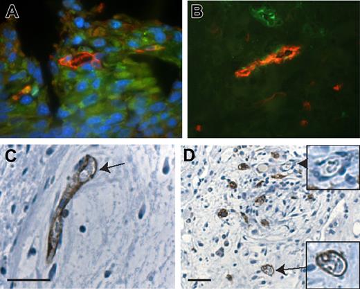 Figure 2. Vessel formation of hESC-derived endothelial cells (ECs). (A) Vessellike structures formed in engineered skeletal muscle constructs in vitro (original magnification × 1000; 100 ×/1.40 oil-immersion objective lens). hESC-derived ECs (PECAM1+) were coseeded with skeletal myoblasts on PLGA-PLLA scaffold and cultured for 10 days. The construct was then fixed and immunostained for desmin (green), PECAM1 (red), and Dapi (blue). (B) The muscle constructs were implanted into murine muscle for 2 weeks, after which labeled lectin (red) was injected into the mice tail veins. Sections of the implant muscle were stained with human PECAM1 antibodies (green). The image shows functional (lectin perfused) human-derived endothelial vessels (original magnification × 1000; 100 ×/1.40 oil-immersion objective lens). Fluorescent micrographs were taken at 25°C using a fluorescent motorized microscope (Axiovert 200) equipped with an Orca digital camera (Hamamatsu). OpenLab and Fluoromount were used as imaging software and medium, respectively. (C,D) hEB differentiating cells were seeded on PLGA-PLLA scaffolds, grown for 2 weeks, and then transplanted in SCID mice. After 2 weeks, the constructs were retrieved and tissue was fixed and stained for antihuman PECAM1. Arrows indicate vessels lined by human endothelial cells. Original magnifications of panels C and D are × 1000 (100 ×/1.40 oil immersion objective lens) and × 400 (40 ×/0.6 NA air objective lens), respectively. Micrographs were taken at 25°C using an inverted microscope (Axiovert 200) equipped with an AxioCam colored camera (Carl Zeiss). AxioVision 3.1 (Carl Zeiss) was used as imaging software. DAB was used as fluorochrome.