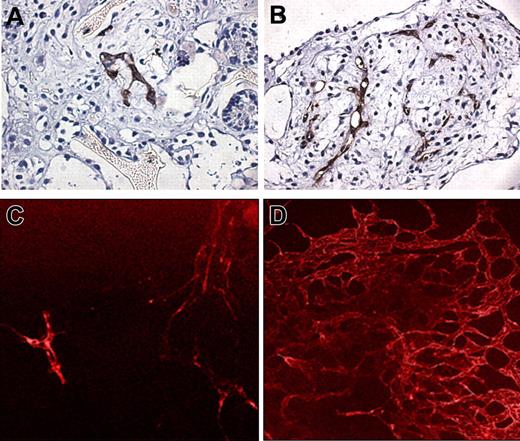 Figure 4. Vessellike network organization in 3D culture assay. (A,B) Dissociated EBs (8 days old) were seeded on PLGA-PLLA scaffolds and incubated for 2 weeks. The scaffold was then fixed in formalin and immunostained with anti-PECAM1 (original magnification, × 100; 10×/0.3 NA oil-immersion lens). Micrographs were taken at 25°C using an inverted microscope (Axiovert 200, Carl Zeiss) equipped with an AxioCam colored camera. AxioVision 3.1 was used as imaging software. DAB was used as fluorochrome. (C,D) A vessellike network was formed during differentiation of the EBs. hEBs obtained on day 6 (panel C) and day 13 (panel D) were fixed and stained for anti-PECAM1 to exhibit the advancement in the vascularization process and formation of complex vascular network (original magnification, × 100; 10×/0.3 NA oil-immersion lens). Micrographs were taken at 25°C using a fluorescent motorized microscope (Axiovert 200, Carl Zeiss) equipped with an Orca digital camera (Hamamatsu). OpenLab and Fluoromount were used as imaging software and medium, respectively.