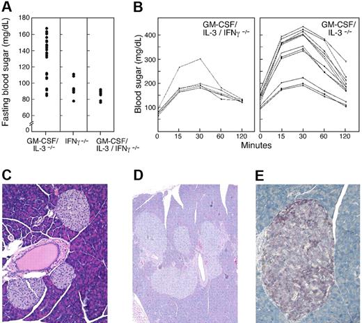 Figure 5. IFN-γ is required for diabetes in GM-CSF/IL-3–deficient mice. (A) Fasting blood sugar levels were determined for IFN-γ–deficient (n = 8) and GM-CSF/IL-3/IFN-γ–deficient (n = 10) mice and compared with GM-CSF/IL-3–deficient mice shown in Figure 2. GM-CSF/IL-3/IFN-γ–deficient animals showed significantly reduced fasting blood sugar levels compared with GM-CSF/IL-3–deficient mice (P < .001). (B) Glucose tolerance tests were performed on GM-CSF/IL-3/IFN-γ–deficient mice (n = 6). Peak glucose levels were significantly reduced compared with GM-CSF/IL-3–deficient animals shown in Figure 3 (P < .001). (C) Absence of insulitis in a GM-CSF/IL-3/IFN-γ–deficient mouse, original magnification ×200. (D) Islet cell adenomas in GM-CSF/IL-3/IFN-γ–deficient mouse, original magnification ×200. (E). Insulin (red) and somatostatin (brown) staining in adenoma in GM-CSF/IL-3/IFN-γ–deficient mouse, original magnification ×400.