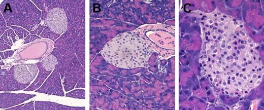Figure 7. Anti–CTLA-4 antibody triggers insulitis in young GM-CSF/IL-3–deficient mice. (A) Normal islets in a wild-type mouse treated with anti–CTLA-4 mAb, original magnification, × 60. (B) Normal islets in a young GM-CSF/IL-3–deficient mouse treated with control Ig, original magnification, × 200. (C) Insulitis in a young GM-CSF/IL-3–deficient mouse treated with anti–CTLA-4 mAb, original magnification, × 400.