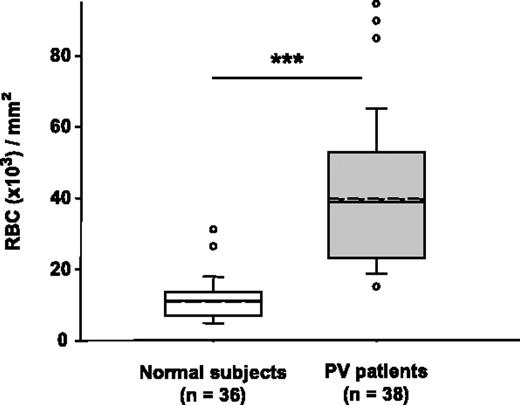 Figure 1. RBCs from patients with PV adhere in greater numbers to HUVECs than RBCs from healthy volunteers under static conditions. RBC adhesion was measured using 51Cr-labeled RBCs. The nonadherent RBCs were removed by successive washes,6 and the radioactivity was measured in each wash and in the remaining RBCs attached to the HUVECs. The number of adherent RBCs was calculated. The unbroken line within the box represents the median; the dotted line represents the mean. The vertical lines extending beyond the boxes indicate the 25% and 75% percentiles, while the horizontal bars outside the boxes represent the 10% and 90% percentiles. ○ indicates the values outside this range. The RBC adhesion was significantly higher in the group of patients with PV compared with healthy volunteers (***P < .001).