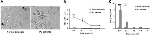 Figure 2. RBCs from patients with PV adhere more efficiently to HUVECs than RBCs from healthy volunteers under flow conditions and are resistant to wash-off by increasing shear stress. (A) A typical microscopic image shows that PV RBCs adhere to a higher extent to HUVECs than healthy volunteer RBCs after inflow at 0.03 Pa and washout (1.00 Pa). (B) Number of RBCs remaining adherent to HUVECs in microslides after inflow at 0.03 Pa and washout at increasing shear stress. (C) Number of RBCs adherent to HUVECs after inflow at different wall shear stresses **P < .01; ***P < .001 for PV RBCs compared with normal RBCs. Bars denote SEM.