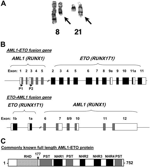 Figure 1. The 8;21 chromosomal translocation. (A) A chromosome preparation of a t(8;21) patient depicting normal chromosome 8, a shorter chromosome 8 with the translocated chromosome 21 (left arrow), normal chromosome 21, and a longer chromosome 21 fused to the portion of chromosome 8 (right arrow). The image was kindly provided by Dr Janet Rowley. (B) Genomic structure of t(8;21). Depicted are the exons of both AML1 and ETO organized following the reciprocal translocation. The first 5 exons of AML1 are fused to exons 2 through 11 of ETO. P1 and P2 with the horizontal arrows denote the start sites of transcription based on the usage of the distal (P1) or proximal (P2) promoters of AML1. The reciprocal ETO-AML1 fusion shows exons 1b and 1a of ETO fused to exons 6 through 12 of AML1. Filled boxes and blank boxes indicate translated and untranslated exon sequences, respectively. (C) Protein structure of AML1-ETO. As explained in the text, the commonly known full-length AML1-ETO protein is a 752-amino acid protein. The N-terminal portion of AML1 up to its runt homology domain (RHD) is fused to most of the ETO protein. Shown are the regions of homology to the Drosophila Nervy protein (NHR1 to NLH4) and 3 proline-serine-threonine-rich (PST) regions. The vertical arrow points to the fusion junction between AML1 and ETO.