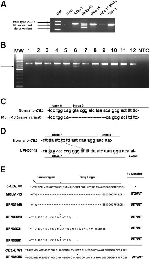 Figure 1. Aberrant CBL transcripts in AML. (A) RT-PCR screening of AML cell lines and the RS(4;11) acute lymphoblastic leukemia (ALL) cell line was carried out as described in “Patients, materials, and methods.” Gel electrophoresis of resulting amplification products using a primer set covering human c-CBL exons 2 through 9 revealed major and minor transcript variants (gray arrows) in the MOLM-13 cell line. MW indicates 1 kb + DNA size ladder; NTC, no template control reaction. (B) RT-PCR screening for c-CBL transcript was performed using AML patient samples (lanes 1-12). A representative agarose gel is shown. (Lane 6) UPN03149 expresses a smaller transcript variant (arrow) and the wild-type mRNA for c-CBL. MW indicates 1 kb + DNA size marker; NTC, no template control reaction. (C) Partial sequence alignment of gDNA PCR amplification products in MOLM-13 compared with the normal c-CBL gene sequence. MOLM-13 is missing 14 bp at the exon 8-intron 8 boundary, including the normal “G” donor site. (D) Partial sequence alignment of gDNA PCR amplification products in UPN03149 relative to wild-type c-CBL DNA. UPN03419 is missing 4 bp that is replaced with a 12-bp sequence. (E) The predicted amino acid sequences derived from the region of interest of mutant CBL transcripts are shown in comparison with the corresponding CBL WT sequence. FLT3 TK allelic status, that is, absence (WT/WT) or presence of internal tandem duplication (FLT3-ITD) or activating domain mutations (FLT3-TKD), was determined for each case of AML and is shown on the right. Asterisk indicates location of missense mutation or nucleotide insertion that gives rise to an amino acid change.