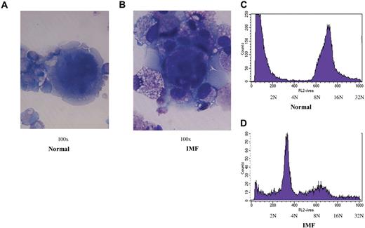 Figure 3. MK morphology and ploidy after 15 days of culture. (A,B) Representative photomicrographs demonstrating the morphology (100 ×/0.75 NA oil objective, Olympus BH-2 microscope, Nikon digital sight DS-L1 camera) of normal and IMF MKs generated from CD34+ cell cultures after 15 days of incubation. (C,D) demonstrate DNA content of CD41+ cells generated from a representative sample of normal and IMF CD34+ cells as determined flow cytometrically.