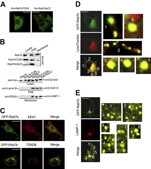 Figure 5. Rab7b is a small GTPase localized to late endosomes and lysosomes. (A) Distribution of Rab7b mutants in Raw 264.7 cells. Raw 264.7 cells were transiently transfected with His-tagged Rab7bT22N or Rab7b▵CC; 48 hours later, cells were immunostained with anti-His Ab and Orange Green 488-conjugated secondary Ab. (B) Examination of the subcellular localization of full-length Rab7b and Rab7b mutants in stable Raw 264.7 transfectants by Western blotting of the lysate, postnuclear supernatant, and membrane factions using anti-His Ab (upper panel). The lysate, postnuclear supernatant, and membrane fractions were also probed with indicated Abs (lower panel) to show the loading quantity and the fractionation specificity. (C-E) Confocal analysis of Rab7b subcellular localization. Raw 264.7 cells were transiently transfected with GFP-Rab7b plasmid; 48 hours later, cells were labeled with LysoTracker Red (D), or immunostained with first Ab against EEA-1 (C), TGN38 (C), or LAMP-1 (E) and Alexa Fluo 555-conjugated secondary Ab. The slides were finally examined under confocal microscopy, and representative images were presented. In panels D and E, the numerated regions were magnified and shown correspondingly at the right. (Bar = 100 μm).
