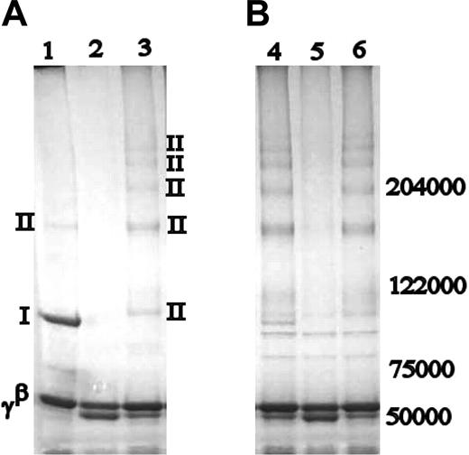 Figure 2. Cross-linking of fibrinogen and fibrin by tTG. Comparison of FXIIIa (A) and guinea pig tTG-cross-linked products (B). Lanes 1 and 4: normal recombinant fibrin; lanes 2 and 5: γQ398N/Q399N/K406R; lanes 3 and 6: γK406R. Bands are labeled as in Figure 1. With the exception of a faint γ-dimer band, the cross-linking pattern in tTG-cross-linked normal recombinant fibrin is similar to that of FXIIIa- and tTG-cross-linked γK406R. Nature of the cross-linking bands was identified by Western blotting.