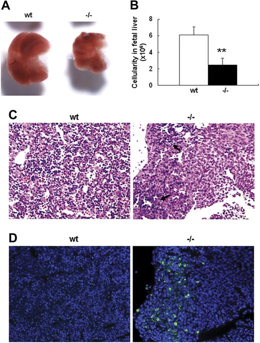 Figure 2. Defective fetal liver definitive erythropoiesis in palladin-deficient embryos. (A) Typical images of wt and Palld−/− E13.5 fetal livers. (B) The cellularity of wt and Palld−/− E13.5 fetal livers. Error bar represents plus and minus a SD; **P < .01. (C) H&E staining of wt and Palld−/− fetal liver sections. (D) TUNEL assay shows increased apoptosis in Palld−/− fetal liver at the same location as in panel C. Note that the apoptosis mainly occurs in the region where hematopoiesis takes place (arrows). (C,D) Images were viewed with an Olympus BX51 microscope with an Olympus UPlanFl 10×/0.30 objective, captured with a SPOT RTKE cooled color CCD camera (Diagnostic Instruments), and imported into SPOT software (Diagnostic Instruments). In panel D, DAPI (nuclei) and FITC (apoptotic cells) fluorescence are shown. Original magnification, × 100.