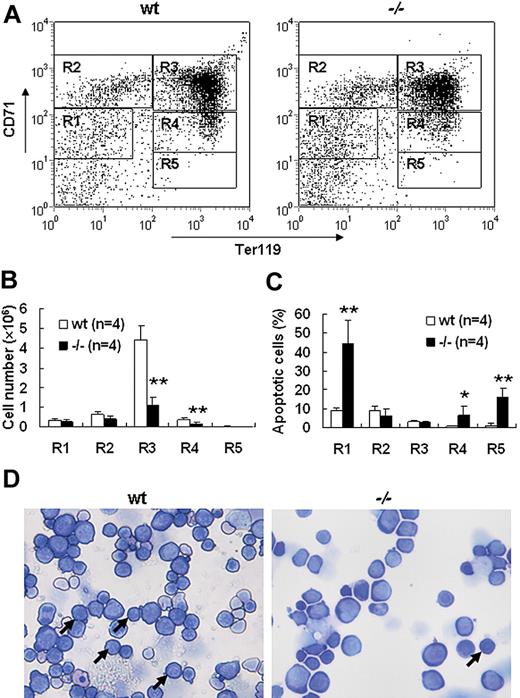 Figure 4. Increased apoptosis and partial differentiation blockage of erythroblasts after palladin disruption. (A) Typical flow cytometric profiles of wt and Palld−/− fetal liver single cells stained with CD71 and Ter119 are shown. Gates from R1 to R5 are set as indicated. (B) Comparison of wt and Palld−/− fetal livers in the ratio of R1 to R5. (C) The ratio of annexin V–positive cells from R1 to R5 was compared in wt and Palld−/− fetal livers. (D) Wt and Palld−/− fetal liver single-cell cytospins were stained with Wright-Giemsa; arrows indicate the R3 population. Images were viewed with an Olympus BX51 microscope with an Olympus UplanFl 20×/0.50 objective, captured with a SPOT RTKE cooled color CCD camera (Diagnostic Instruments), and imported into SPOT software (Diagnostic Instruments). Note that Palld−/− fetal liver has a decreased R3 population. Error bar represents plus and minus a SD; **P < .01; *P < .05. Original magnification, × 200.