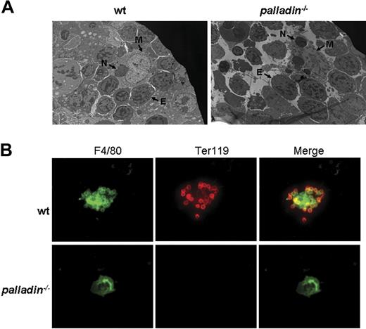 Figure 6. Impaired fetal liver erythroblastic island formation after palladin disruption. (A) Transmission electron microscopy image of E13.5 wt and Palld−/− fetal livers. The erythroblastic island is composed of a central macrophage (M) and surrounding erythroblasts (E). In wt fetal liver, the connection between macrophage and erythroblasts is coherent, while this coherent connection is dispersed after palladin disruption. Note several phagocytosed nuclei (indicated as “N”) existing in mutant macrophage. (B) Native erythroblastic islands isolated from wt and Palld−/− fetal livers were double-immunostained with F4/80 (green) and TER 119 (red) as described in “Materials and methods.” F4/80 is macrophage-specific marker, and Ter119 is the marker for erythroblasts. Note that Palld−/− fetal liver cells could not form an erythroblastic island in this in vitro macrophage and erythroblast coculture assay. Images were viewed with an Olympus BX51 microscope with an Olympus UPlanFl 40×/0.75 objective, captured with a SPOT RTKE cooled color CCD camera (Diagnostic Instruments), and imported into SPOT software (Diagnostic Instruments). FITC (F4/80+ cells) and PE (Ter119+ cells) fluorescence are shown. Original magnifications, × 3000 (panel A) and × 400 (panel B).