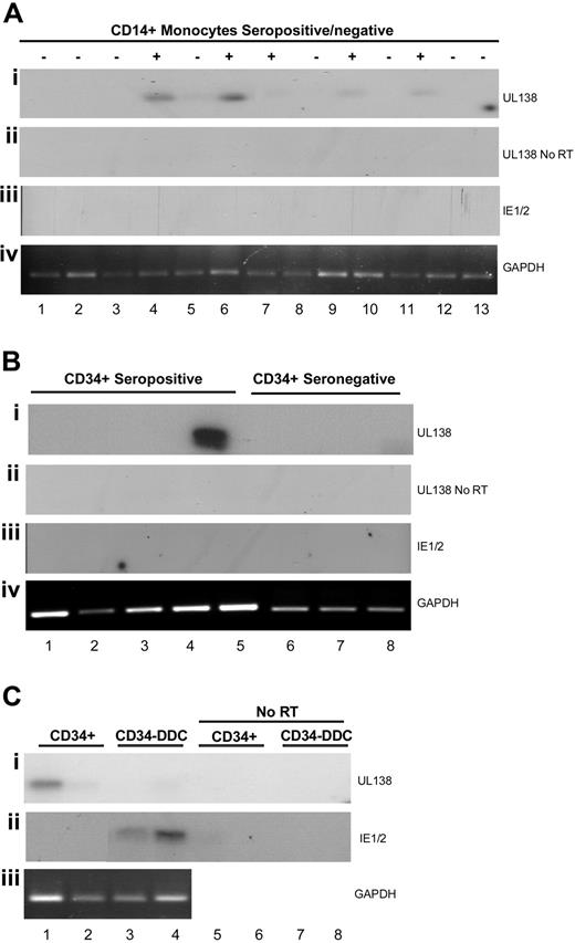 Figure 5. Detection of UL138 RNA in hematopoietic cells isolated from seropositive donors. (A) RNA isolated from CD34+ cells of seropositive (lanes 1-5) or seronegative (lanes 6-8) donors was analyzed by RT-PCR for (i) UL138, (iii) IE1, and (iv) GAPDH gene expression. RNA was amplified in panel ii with no prior RT. (B) RNA isolated from peripheral blood monocytes of seropositive (lanes 4, 6, 7, 9, and 11) or seronegative (lanes 1-3, 5, 8, 10, 12, 13) donors was analyzed by RT-PCR for (i) UL138, (iii) IE1, and (iv) GAPDH gene expression. RNA was also amplified in panel ii with no prior RT. (C) RNA isolated from CD34+ cells (lanes 1, 2, 5, 6) and CD34-derived dendritic cells (DDCs) (lanes 3, 4, 7, 8) of 2 further seropositive donors was analyzed by RT-PCR (lanes 1-4) for (i) UL138, (ii) IE1, and (iii) GAPDH gene expression. RNA was also amplified in an (i) UL138-PCR and (ii) with no prior RT (lanes 5-8). In all experiments, PCR products were transferred to a nitrocellulose membrane and probed with internal sequences to UL138 and IE1 genes.