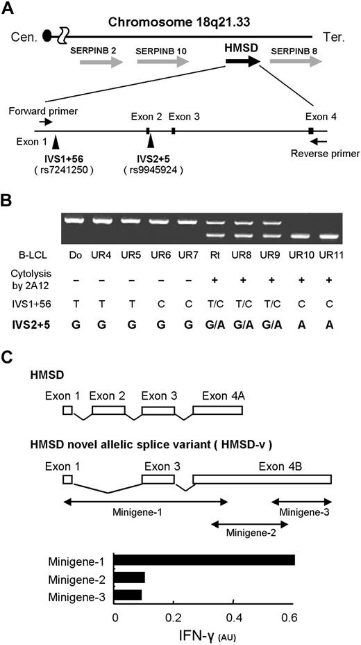 Figure 2. Identification of a novel splice variant transcript of HMSD encoding the mHA. (A) Summary of genome mapping around chromosome 18q21.33 showing relative positions of HMSD. Two identical cDNA clones were homologous to exons 1 and 3 plus exon 4 but lacked exon 2. This novel allelic splice variant of HMSD was designated HMSD-v (panel C). Search for potential SNPs responsible for the alternative splicing revealed 2 potential SNPs at IVS1+56 and IVS2+5 (arrowheads). Cen indicates centromere, Tel, telomere. (B) The correlation between sequence polymorphisms of the 2 SNPs and susceptibility of B-LCLs to CTL-2A12. Detection of allelic polymorphisms in B-LCLs was conducted by RT-PCR. Primers were set in exon 1 and the 5′ part of exon 4 of HMSD (horizontal arrows in panel A). Due to the lack of exon 2, the mHA+ allele produced a smaller PCR product. Genotyping of the 2 SNPs mentioned above and cytolysis of B-LCLs by CTL-2A12 are summarized below the results of electrophoresis. The correlation between the genotyping results of SNPs at IVS2+5, CTL-2A12 cytolysis, and the bands of electrophoresis produced by mHA+ and mHA− allele showed complete concordance. (C) Schematic representation of HMSD and HMSD-v and mapping of the region encoding the CTL-2A12 mHA epitope by minigenes. The HMSD-v cDNA was divided into 3 minigenes, and mammalian expression plasmids containing individual minigenes were constructed. 293T/B*4403 cells were transfected with individual plasmids and cocultured with CTL-2A12. Supernatants were then harvested and assayed for IFN-γ production by ELISA. Release of IFN-γ is expressed in arbitrary units (AUs) corresponding to optical density at 630 nm.