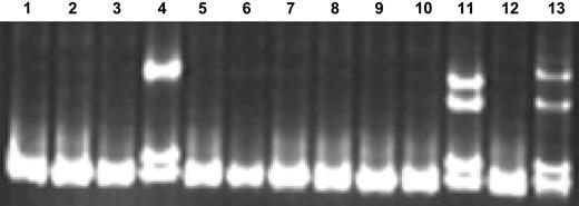 Figure 1. SSCP gel demonstrating NPMc+ screening method. (Lane 12) NPM wild-type (NPMc−) control sample; (lane 13) NPMc+ control sample; (lanes 1-11) unknown samples. Lanes 4 and 11 contain samples confirmed to be NPMc+ by direct sequencing.