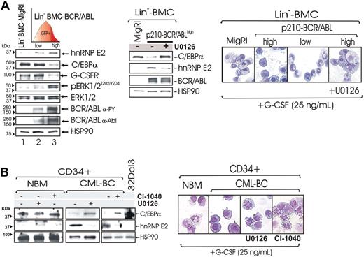 Figure 5. Effect of ERK-dependent suppression of hnRNP-E2 on C/EBPα expression and neutrophilic differentiation of Lin− BMC-BCR/ABLhigh cells and patient-derived CML-BCCD34+ progenitors. (A) Levels of hnRNP-E2, C/EBPα, G-CSFR, phospho-ERK1/2, and total ERK1/2 in lineage-negative (Lin−) mouse bone marrow cells (BMCs) transduced with the empty vector (Lin−BMC-MigRI) or with a p210-BCR/ABL retrovirus and sorted for low and high GFP expression (Lin−BMC-BCR/ABLlow and -BCR/ABLhigh) (left panel). Effect of MAPK inhibition by U0126 on hnRNP-E2 and C/EBPα expression and/or G-CSF–driven differentiation in Lin− BMC-BCR/ABLhigh cells (middle and right panels). May-Grumwald/Giemsa–stained representative microphotographs of Lin− BMC-MigRI, BMC-BCR/ABLlow, untreated, and U0126-treated BMC-BCR/ABLhigh cells (right panel). (B) Effect of MAPK inhibition by U0126 and CI-1040 on hnRNP-E2 and C/EBPα expression in primary CD34+ human normal bone marrow cells (NBMCD34+) and CML-BCCD34+ cells (left panel). May-Grumwald/Giemsa staining of NBMCD34+ and untreated, U0126-treated, and CI-1040-treated CML-BCCD34+ cells (right panel).