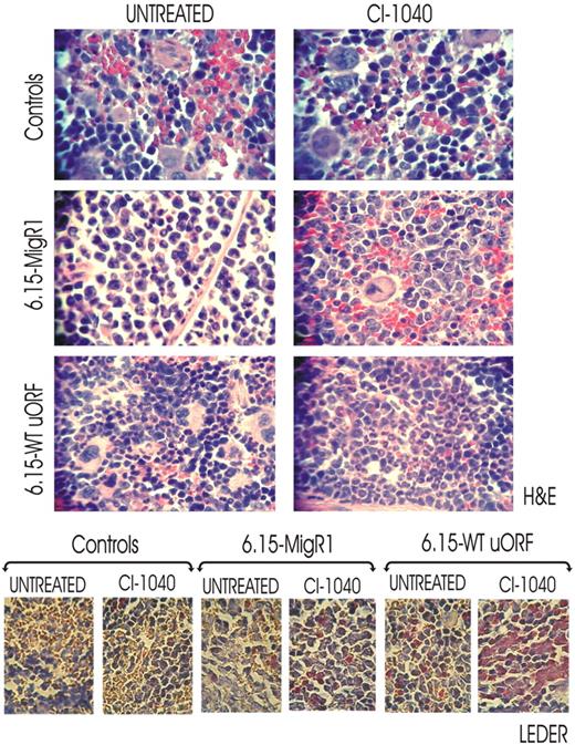 Figure 6. In vivo effect of pharmacologic inhibition of ERK-dependent hnRNP-E2 expression on neutrophilic maturation of differentiation-arrested myeloid 32D-BCR/ABL cells. H&E (top panels) and Leder (bottom panels) staining of the spleen sections of untreated and CI-1040–treated control and 6.15-MigRI and 6.15-WT-uORF cell–injected mice. In addition, all mice were cotreated with G-CSF. Microphotographs are representative of data obtained by analyzing multiples sections of spleens from 3 mice per group.