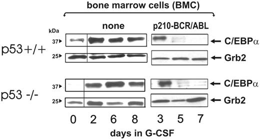 Figure 7. Effect of the p53 genetic background on BCR/ABL-dependent regulation of C/EBPα expression. C/EBPα levels at a different time course in nontransduced (none) and BCR/ABL-transduced wild-type and p53−/− mouse bone marrow cells (BMCs) cultured in the presence of G-CSF for the indicated time.